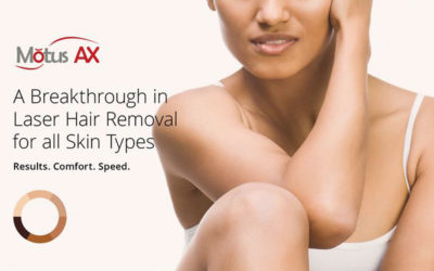 Pain Free Hair Removal with Motus AX