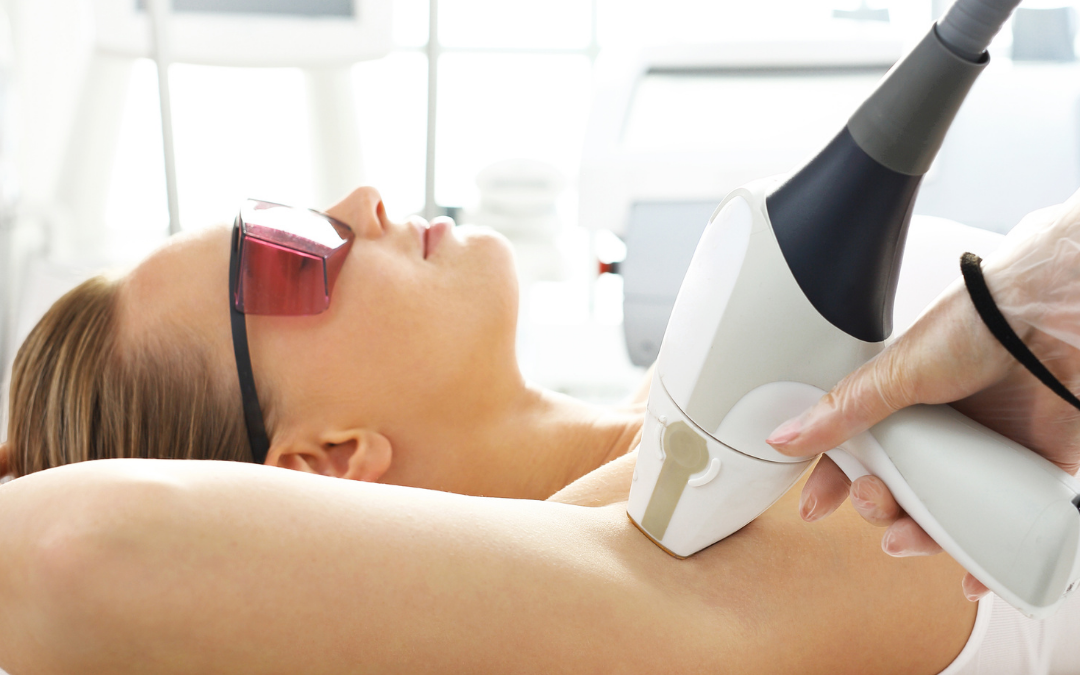 4 Facts You Should Know about Laser Hair Removal