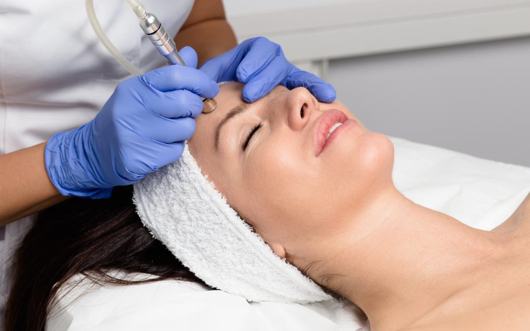 What to Expect from a Microdermabrasion Facial