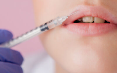 Achieving Natural Results with Injectable Fillers