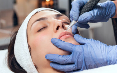The Anti-Aging Benefits of Microneedling