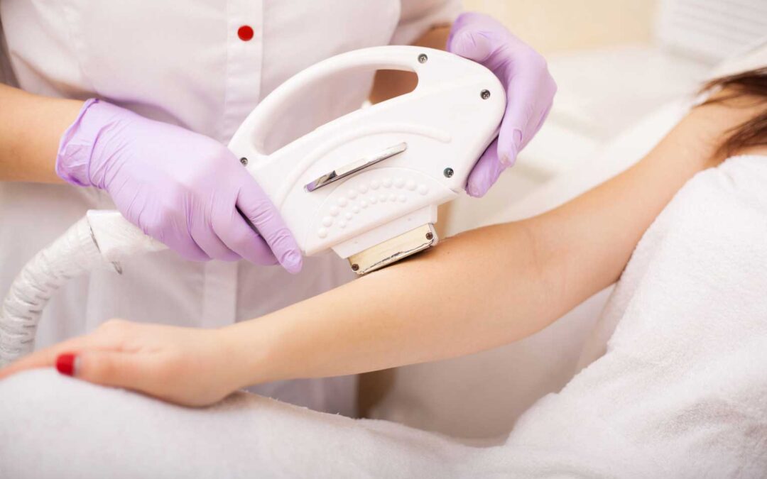 Laser Hair Removal vs. Other Hair Removal Methods