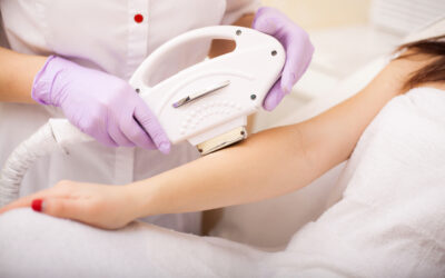 Laser Hair Removal vs. Other Hair Removal Methods